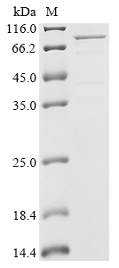 Biotinylated Recombinant Streptococcus Pneumoniae Penicillin-Binding Protein 2X (PBPX) Protein (MBP&His-Avi)