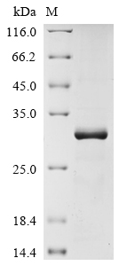 Recombinant Human Claudin-18 (CLDN18) Protein (GST)