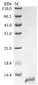 Recombinant Human Claudin-18 (CLDN18) Protein (His)