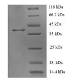 Recombinant Human Corticotropin-Releasing Factor Receptor 1 (CRHR1) Protein (GST)