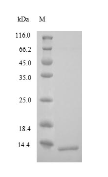 Recombinant Human Corticotropin-Releasing Factor Receptor 1 (CRHR1) Protein (His)