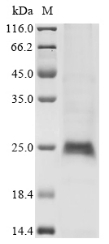 Recombinant Human Cytokine Receptor Common Subunit Gamma (IL2RG) Protein (His)