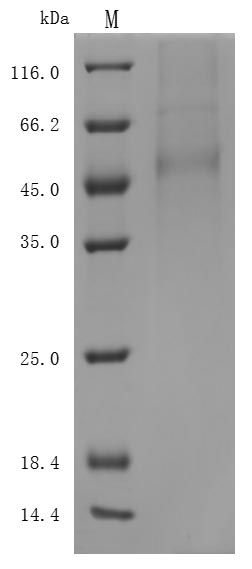 Recombinant Human Delta-Like Protein 3 (DLL3) Protein (His), Active