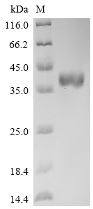 Recombinant Human Delta-Like Protein 3 (DLL3) Protein (mFc)