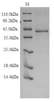 Recombinant Human Endothelin B Receptor (EDNRB) Protein (His), Active