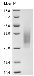 Recombinant Human Parathyroid hormone/parathyroid hormone-related peptide receptor (PTH1R) , partial