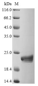 Recombinant Human Programmed Cell Death 1 Ligand 1 (CD274) Protein (His&Myc)