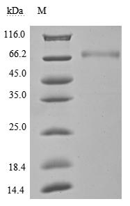 Recombinant Human Programmed Cell Death 1 Ligand 1 (CD274) Protein (hFc), Active