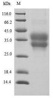 Recombinant Human Programmed Cell Death Protein 1 (PDCD1) Protein (His), Active