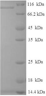 Recombinant Human Raf Proto-Oncogene Serine/Threonine-Protein Kinase (RAF1) Protein (His-SUMO)