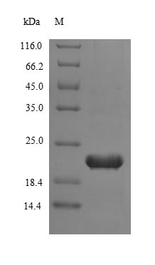 Recombinant Human Telomerase Reverse Transcriptase (TERT) Protein (His)