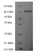 Recombinant Human Thyroid Hormone Receptor Beta (THRB) Protein (His-SUMO)