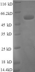 Recombinant Human Tissue Factor Pathway Inhibitor (TFPI) Protein (GST)