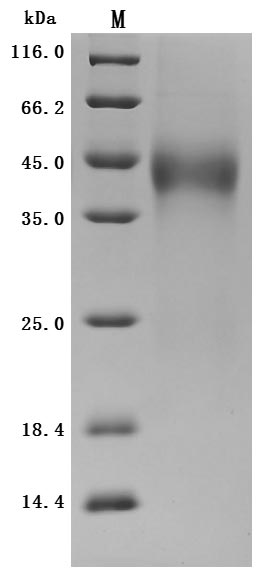 Recombinant Human Tissue Factor Pathway Inhibitor (TFPI) Protein (His), Active