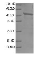 Recombinant Human Tyrosine-Protein Kinase Jak2 (JAK2) Protein (His)