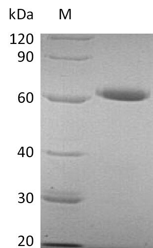 Recombinant Human 5'-Nucleotidase (NT5E) Protein (His), Active